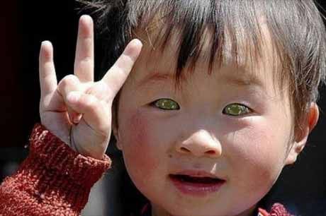 необычный цвет глаз фото